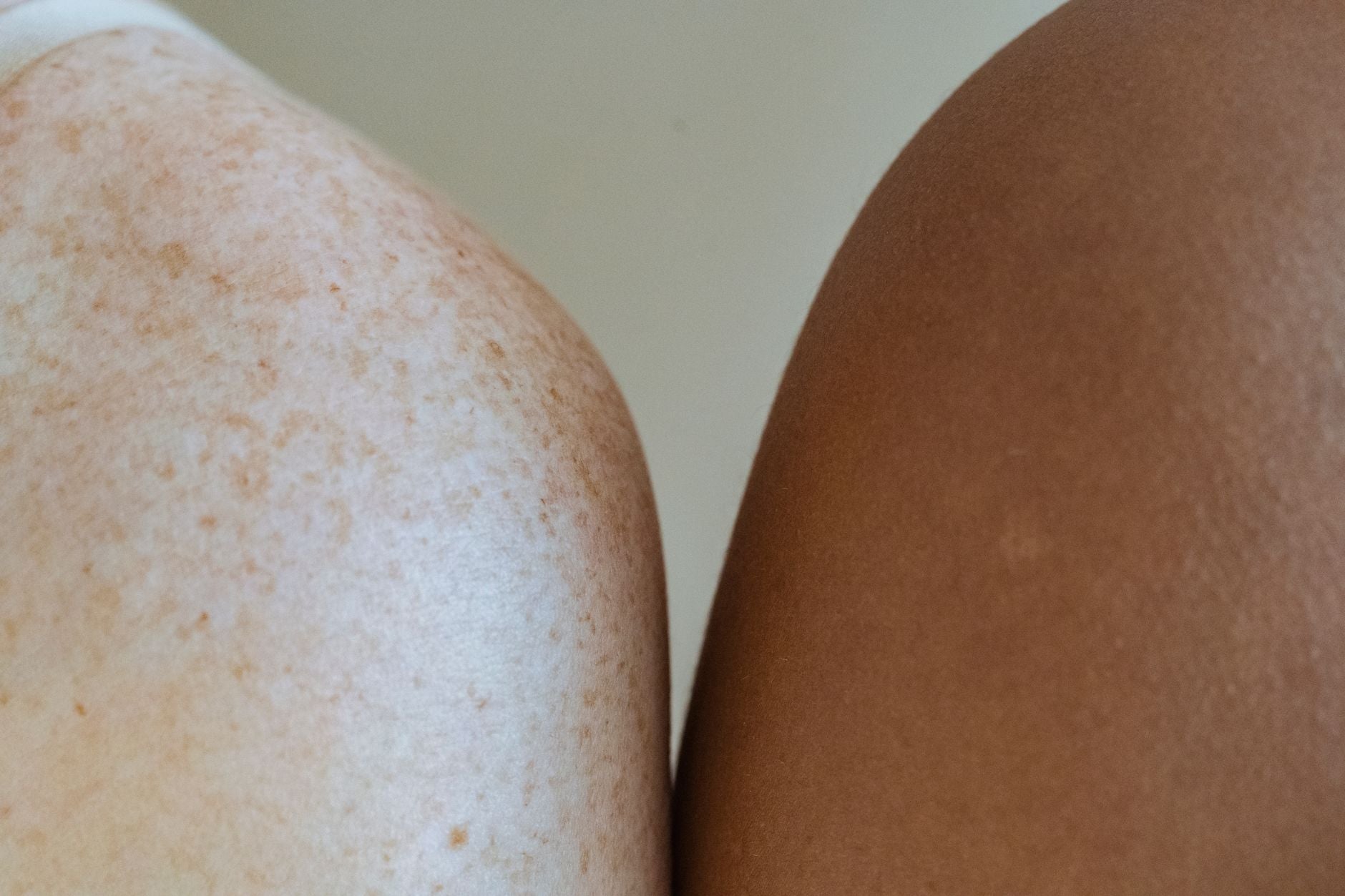 Two bare shoulders side by side, fair sun-spotted skin beside deeper tanned skin in warm natural light
