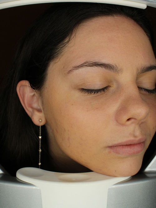 After four pore refining sessions
