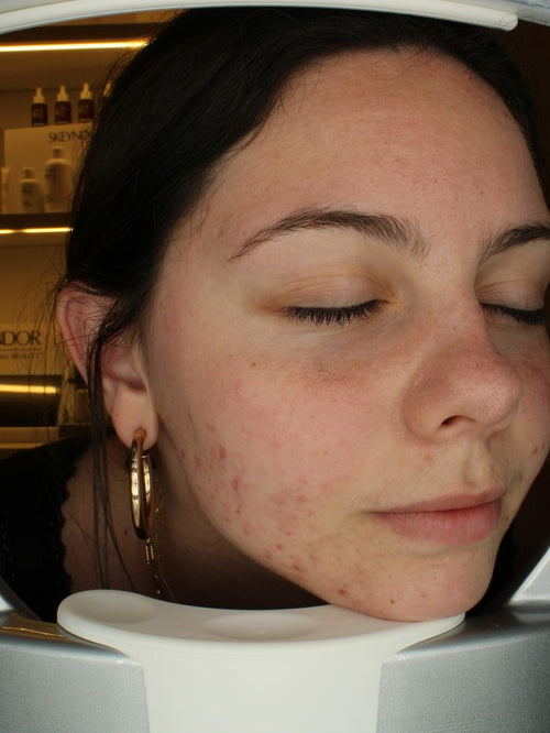 Before pore refining programme